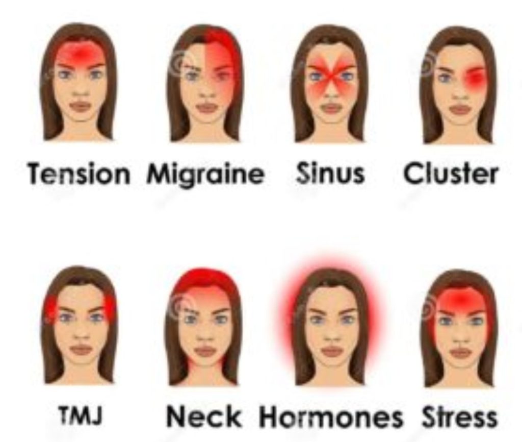 migraine-vs-headache